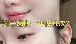 光子嫩肤一次多少钱,一次多少钱让你焕发青春光彩